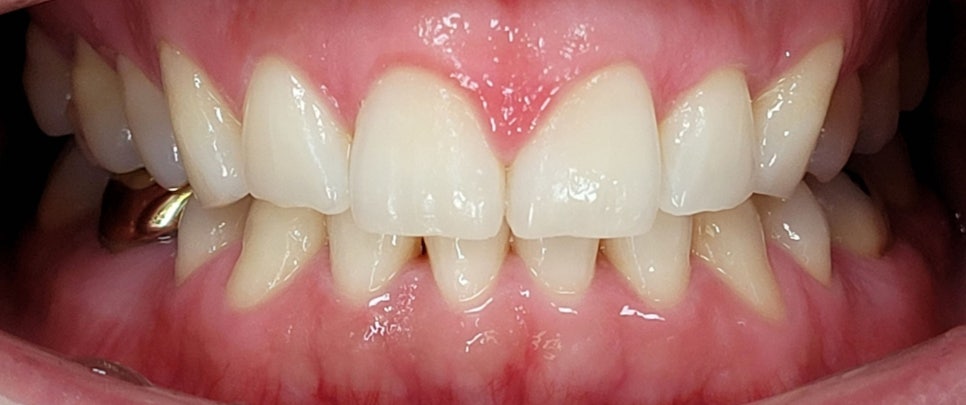 서초동 라미네이트 &lsquo;이런 분들&rsquo;께는 권하지 않습니다 <필독> 관련 이미지 12