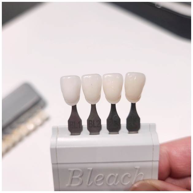 What Matters More Than Implant Prices image 7