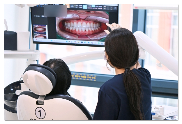 Which Is Better for Crowded Teeth: Veneers or Orthodontic Treatment? image 7