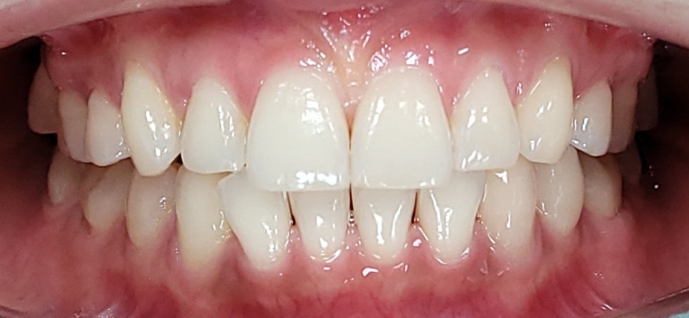 역삼동라미네이트, 결혼 앞두고 고민 중이라면? <필독> 관련 이미지 9