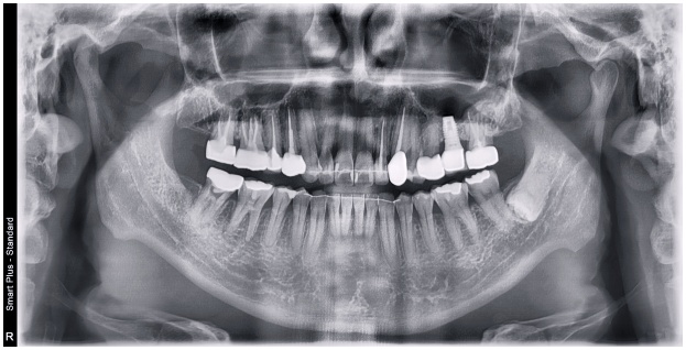 What Matters More Than Implant Prices image 5