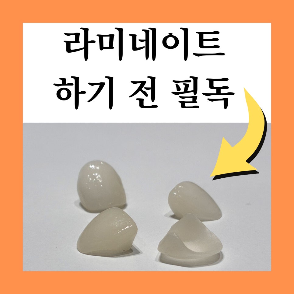 서초동 라미네이트 &lsquo;이런 분들&rsquo;께는 권하지 않습니다 <필독> 관련 이미지 2
