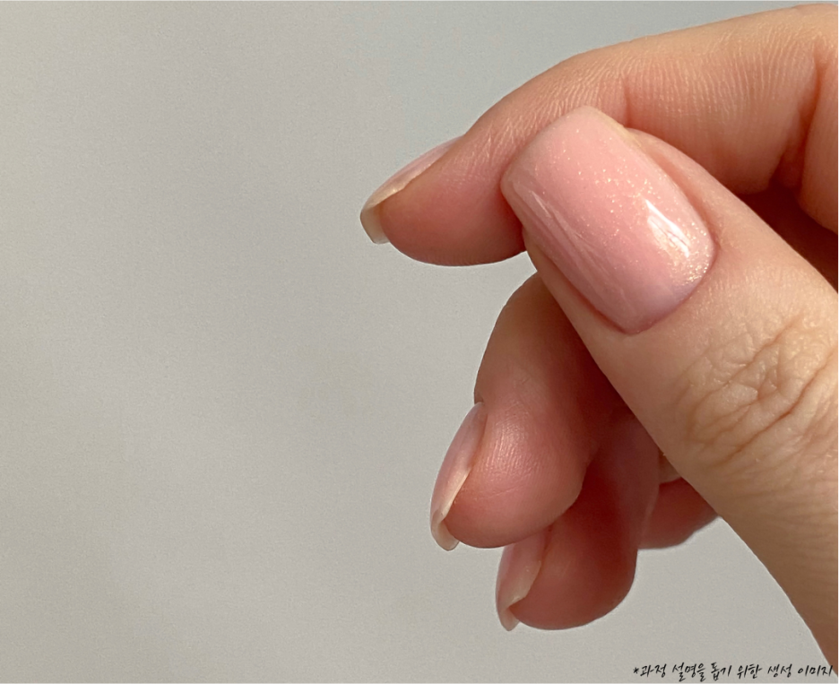 원진치과, 변색된 앞니 브리네이트로 티 안 나게 하는 2가지 기준 (의사조언) 관련 이미지 5