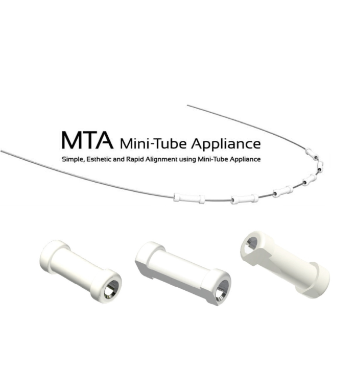 강남원진치과, 앞니부분교정 &lsquo;이 기준&rsquo; 확인하세요 관련 이미지 7