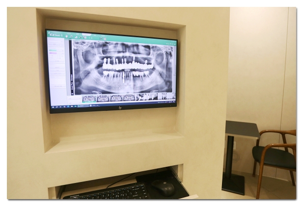 Black Triangles After Orthodontic Treatment: The Solution Depends on the Cause image 4