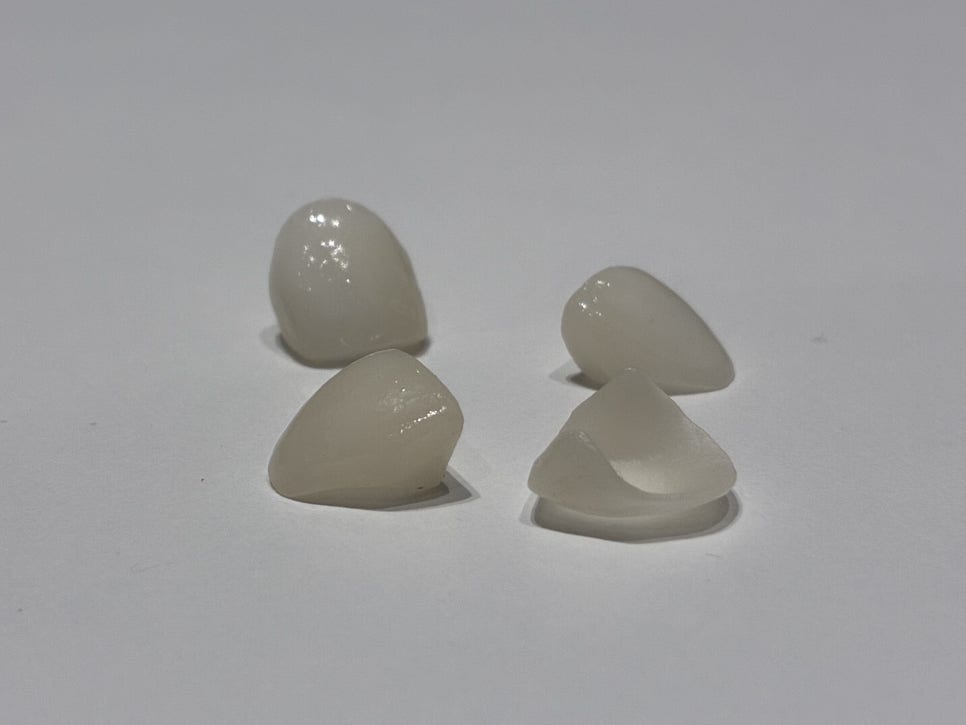 서초동치과, 앞니 사이가 까많게 보여요 <블랙트라이앵글 치료사례> 관련 이미지 11