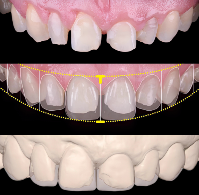 서초동 라미네이트 &lsquo;이런 분들&rsquo;께는 권하지 않습니다 <필독> 관련 이미지 6