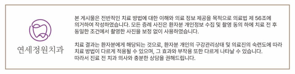 개포동 앞니 사이 공간 및 덧니 교정을 원한다면 관련 이미지 19