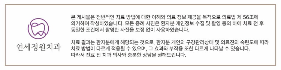 치아에 생긴 흰색 반점? 원인과 ICON 치료의 효과 알아보기 관련 이미지 7