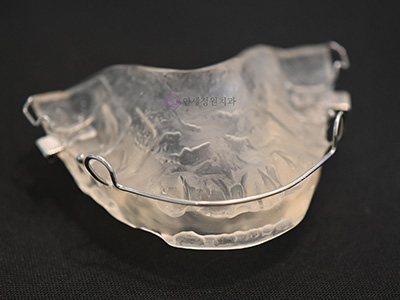 아이들이 더 좋아하는 인비절라인 퍼스트 @ 대치동 교정치과 연세정원치과 관련 이미지 8