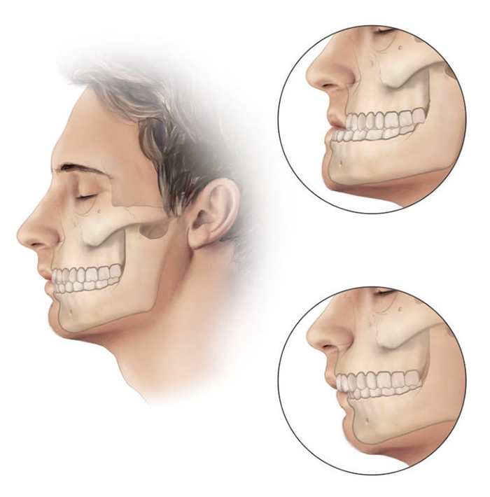 What is the ideal age to begin orthodontic treatment? image 4