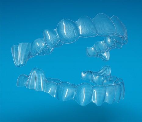 인비절라인의 장점 @ 대치동교정치과 연세정원치과의원 관련 이미지 3