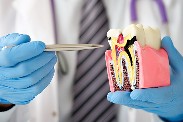 When Your Teeth Feel Sensitive, Is It Just Tooth Sensitivity? A Complete Guide from Causes to Treatment image 3