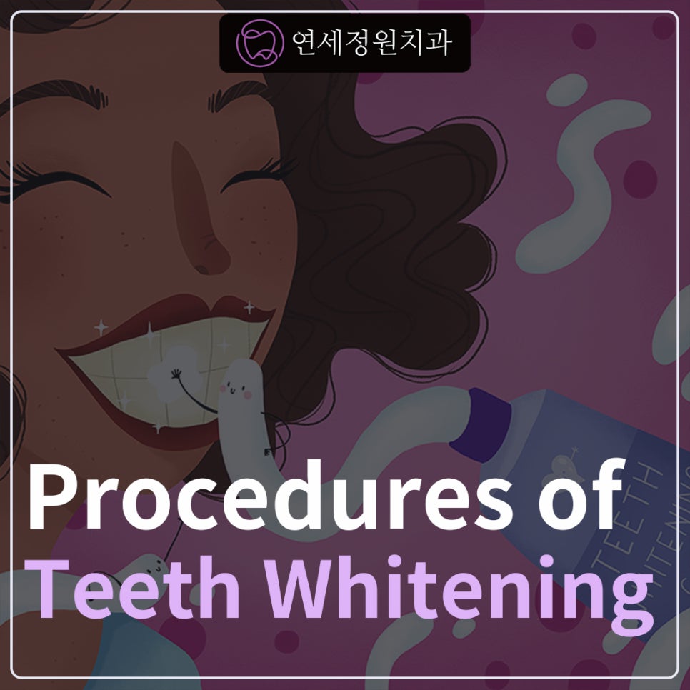 One Day Teeth Whitening Process @ Yonsei JW Dental Clinic 관련 이미지 1