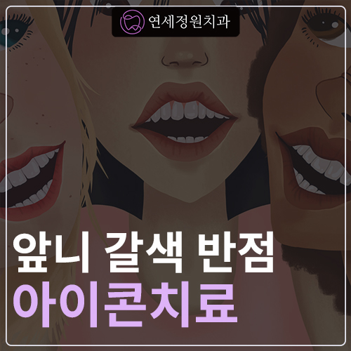 앞니 치아 하얀 점, 하얀 얼룩(화이트 스팟), 갈색 반점 반점치 아이콘 레진 치료 @ 대치동 연세정원치과 관련 이미지 1