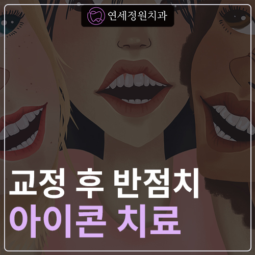 교정치료 후 생긴 치아 하얀 점, 반점치도 아이콘 치료로! @ 대치동 교정치과 연세정원치과의원 관련 이미지 1