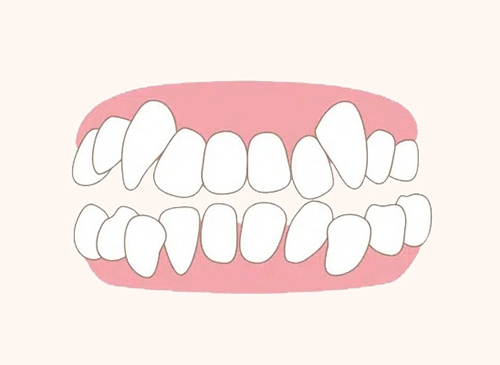 What is the ideal age to begin orthodontic treatment? image 7