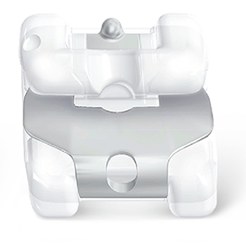 3M 클라리티 울트라 (자가결찰장치) 치아교정 관련 이미지 4