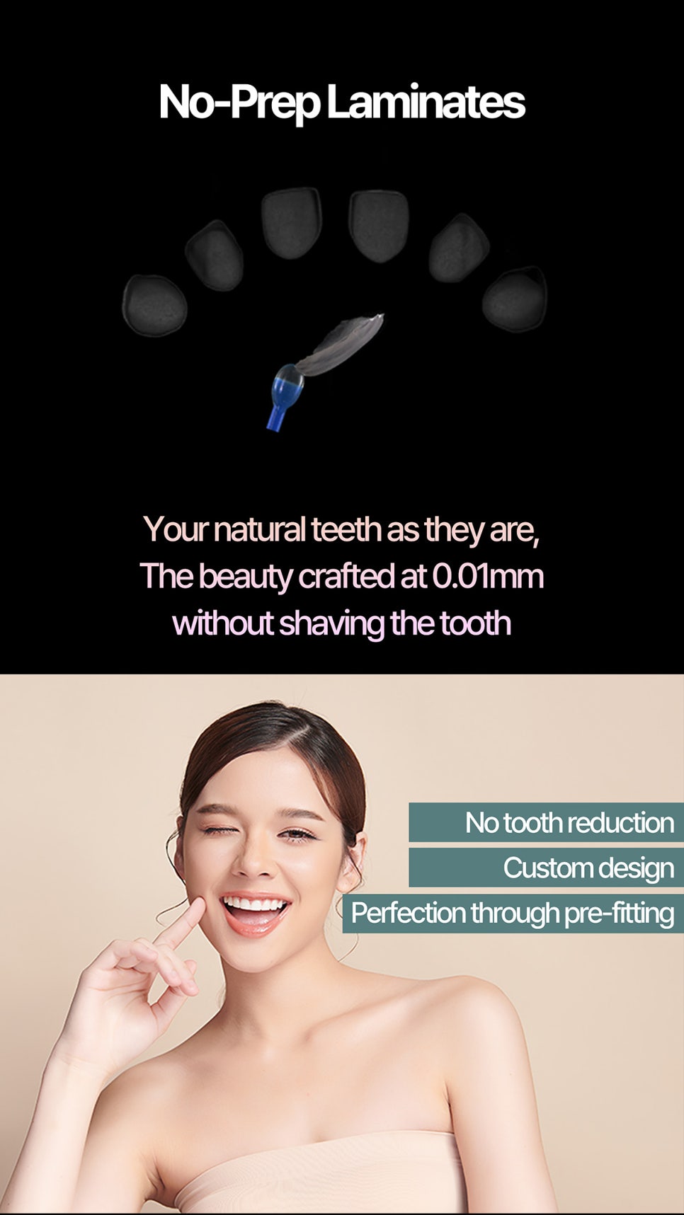 Non-Prep and Minimal-Prep Veneers in Seoul&ndash; Costs & What to Expect 관련 이미지 2