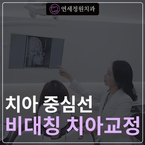 치아 중심선이 안 맞아요! 치아 비대칭 교정으로 가능할까요? @ 대치동 교정치과 연세정원치과 관련 이미지 1