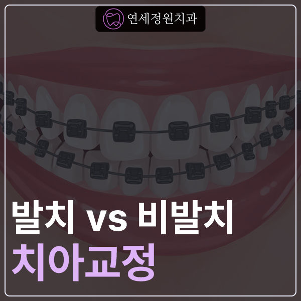 개포동 치아교정, 꼭 이를 뽑아야 할까요? 발치 vs 비발치 관련 이미지 1
