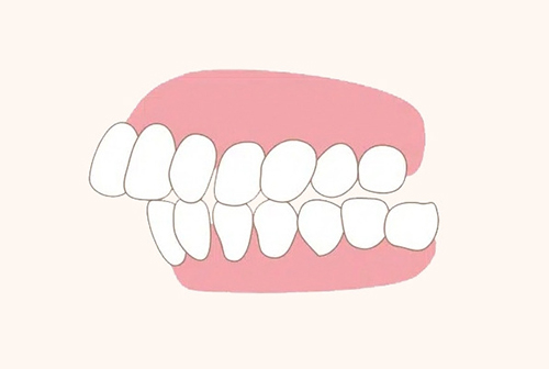 What is the ideal age to begin orthodontic treatment? image 6