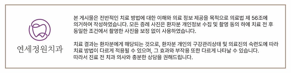 원데이 치아미백 @ 대치동치과 연세정원치과 관련 이미지 14