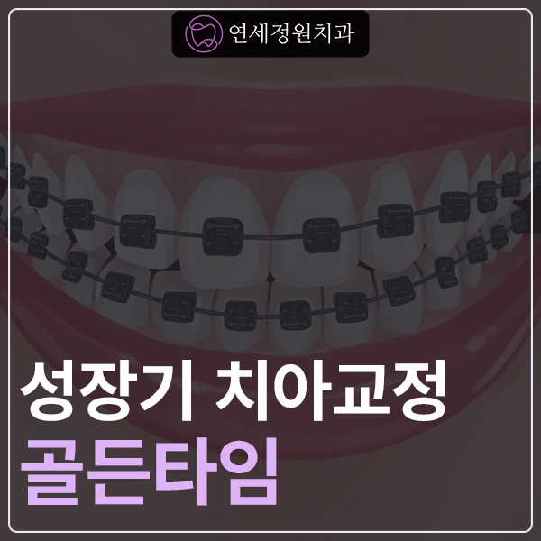 대치동 성장기 어린이 치아교정의 골든타임 관련 이미지 1