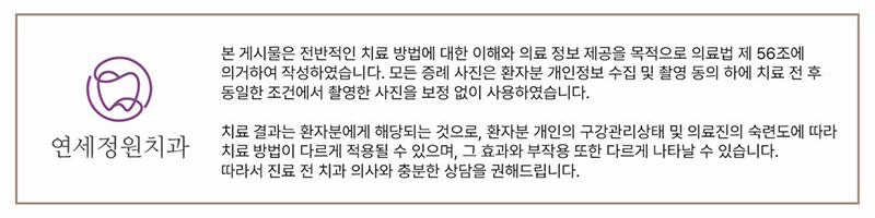 앞니 벌어짐 부분교정 (재교정) 관련 이미지 21