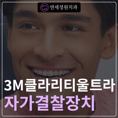 3M 클라리티 울트라 (자가결찰장치) 치아교정 관련 이미지 1