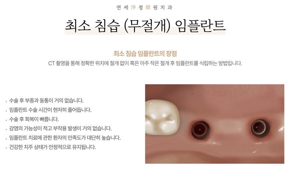 임플란트 식립 전, 후의 주의사항 - 대치동치과 연세정원치과 관련 이미지 6
