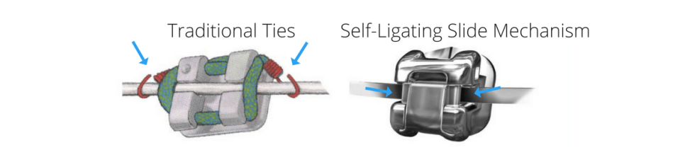 삼성역교정치과 연세정원치과 관련 이미지 2