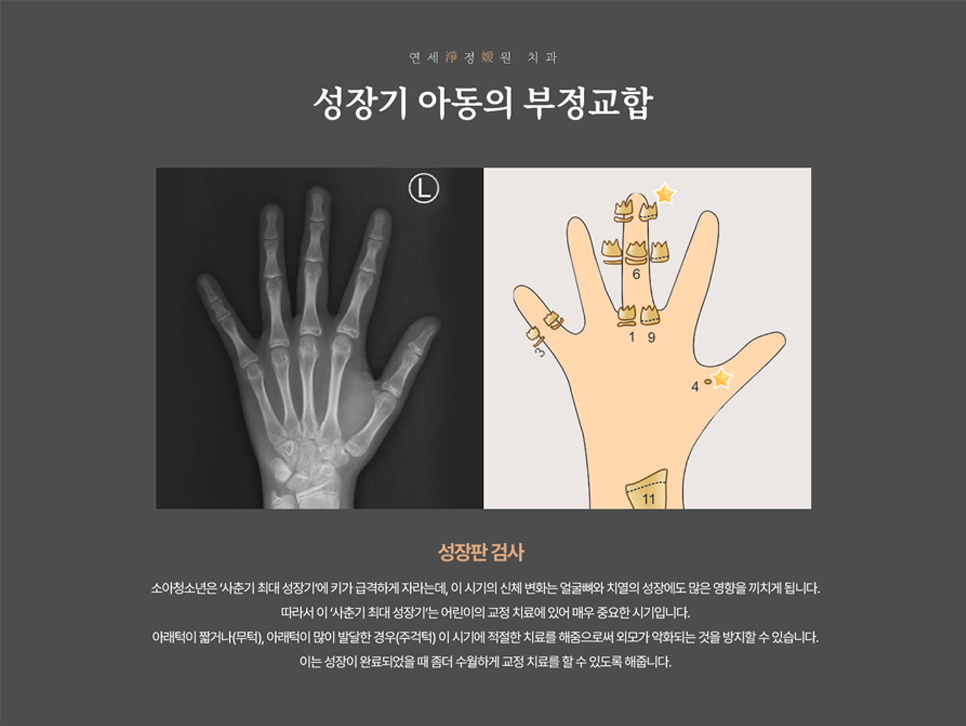 대치동 어린이 치아교정, 타이밍이 중요해요! 관련 이미지 3