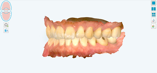 대치동교정치과에서 정밀진단은 어떤 건가요? 연세정원치과 관련 이미지 9
