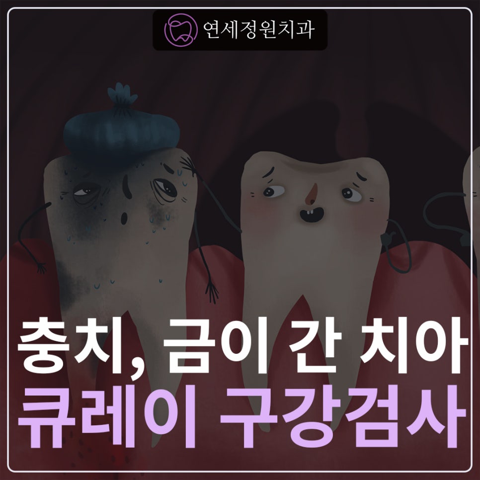 충치, 금이 간 치아의 정확한 진단, 큐레이펜 C(Qraypen C)를 활용한 큐레이 검사 @ 대치동치과 연세정원치과의원 관련 이미지 1