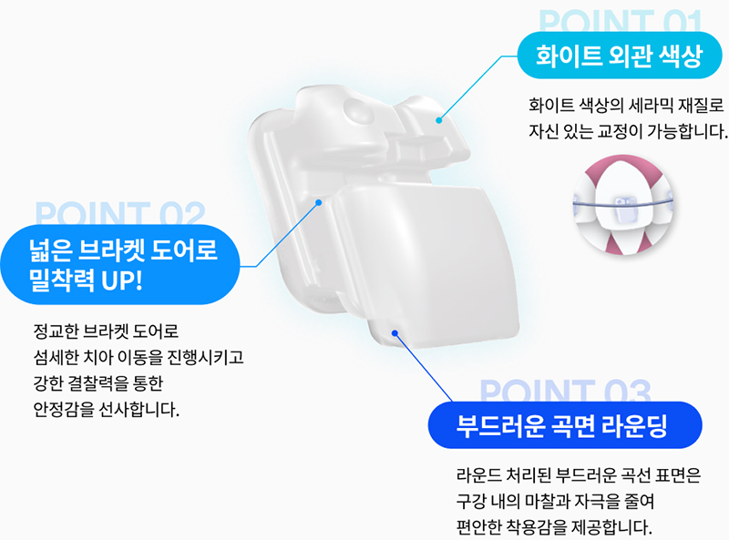 클라리티 울트라 (Clarity Ultra SL) 치아교정 관련 이미지 2