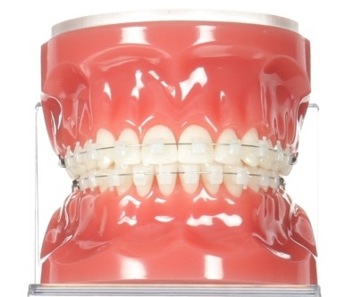 삼성역교정치과 연세정원치과 관련 이미지 3