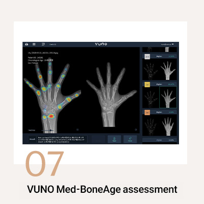 Why Choose Yonsei JW Dental Clinic? 관련 이미지 7