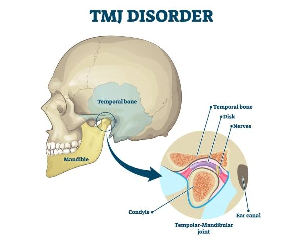 턱관절 치료를 치과에서 해야만 하는 이유 @ 대치동 치과 연세정원치과의원 관련 이미지 3