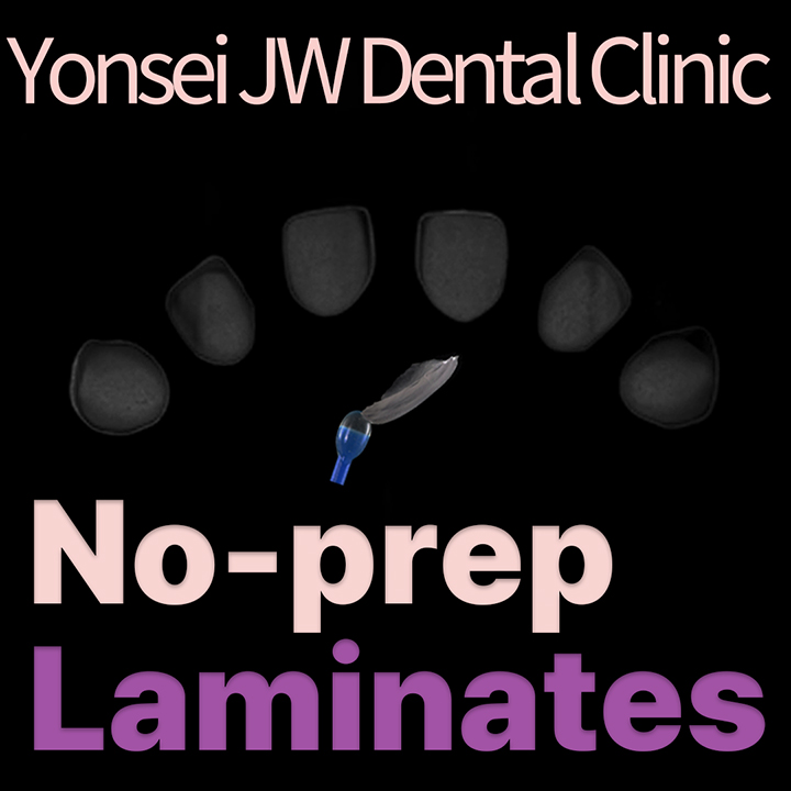 No-prep veneers in Korea: Pros and Cons&ndash; Yonsei JW Dental Clinic 관련 이미지 1