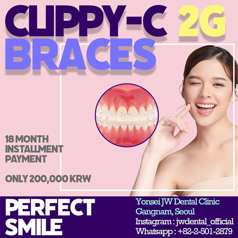 Braces Promotion : Clippy-C 2G Braces 관련 이미지 1