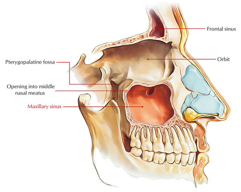 대치동치과 임플란트 수술, 상악동 거상술은 무엇인가요? 관련 이미지 2
