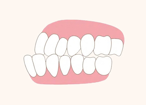 What is the ideal age to begin orthodontic treatment? image 5