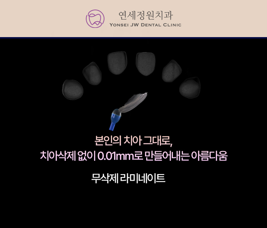 대치동 무삭제, 최소삭제 라미네이트 비용 관련 이미지 2