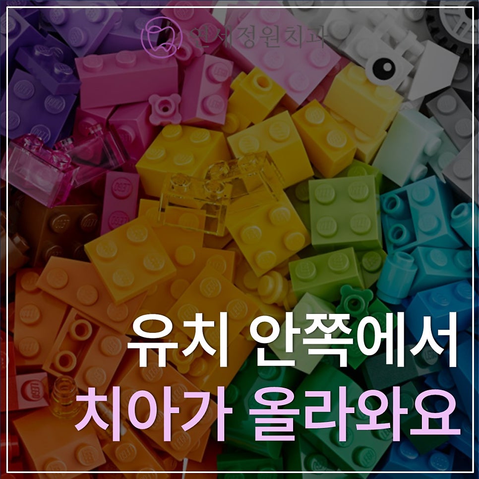 유치 안쪽에서 치아가 올라와요! (대치동 소아치과 연세정원치과) 관련 이미지 1