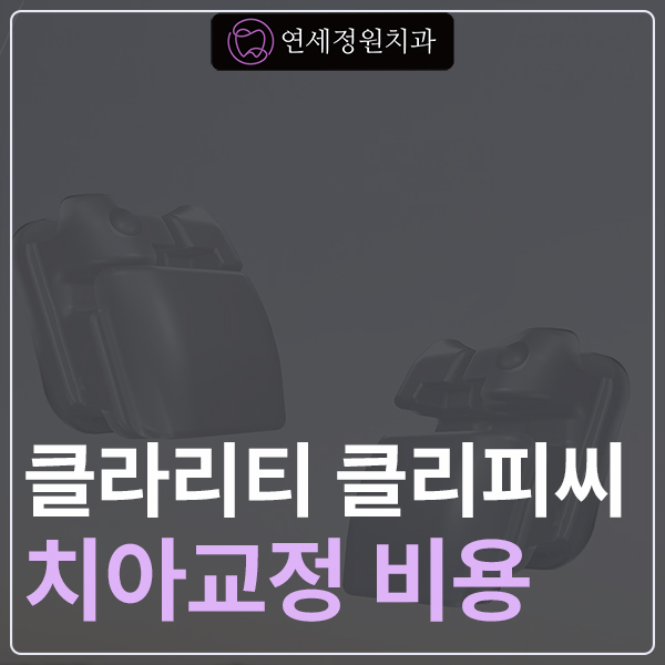 대치동 교정치과 클라리티, 클리피씨 비용 관련 이미지 1