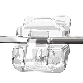 3M 클라리티 울트라 (자가결찰장치) 치아교정 관련 이미지 5