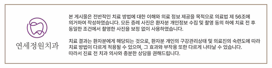 인비절라인 익스프레스 부분교정 <앞니 재교정> 관련 이미지 11