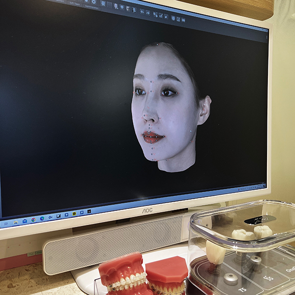 개포동치과의 인비절라인 투명 교정장치로 티 안나게 관련 이미지 4