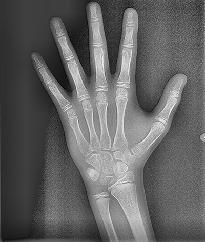 대치동교정치과에서 정밀진단은 어떤 건가요? 연세정원치과 관련 이미지 13